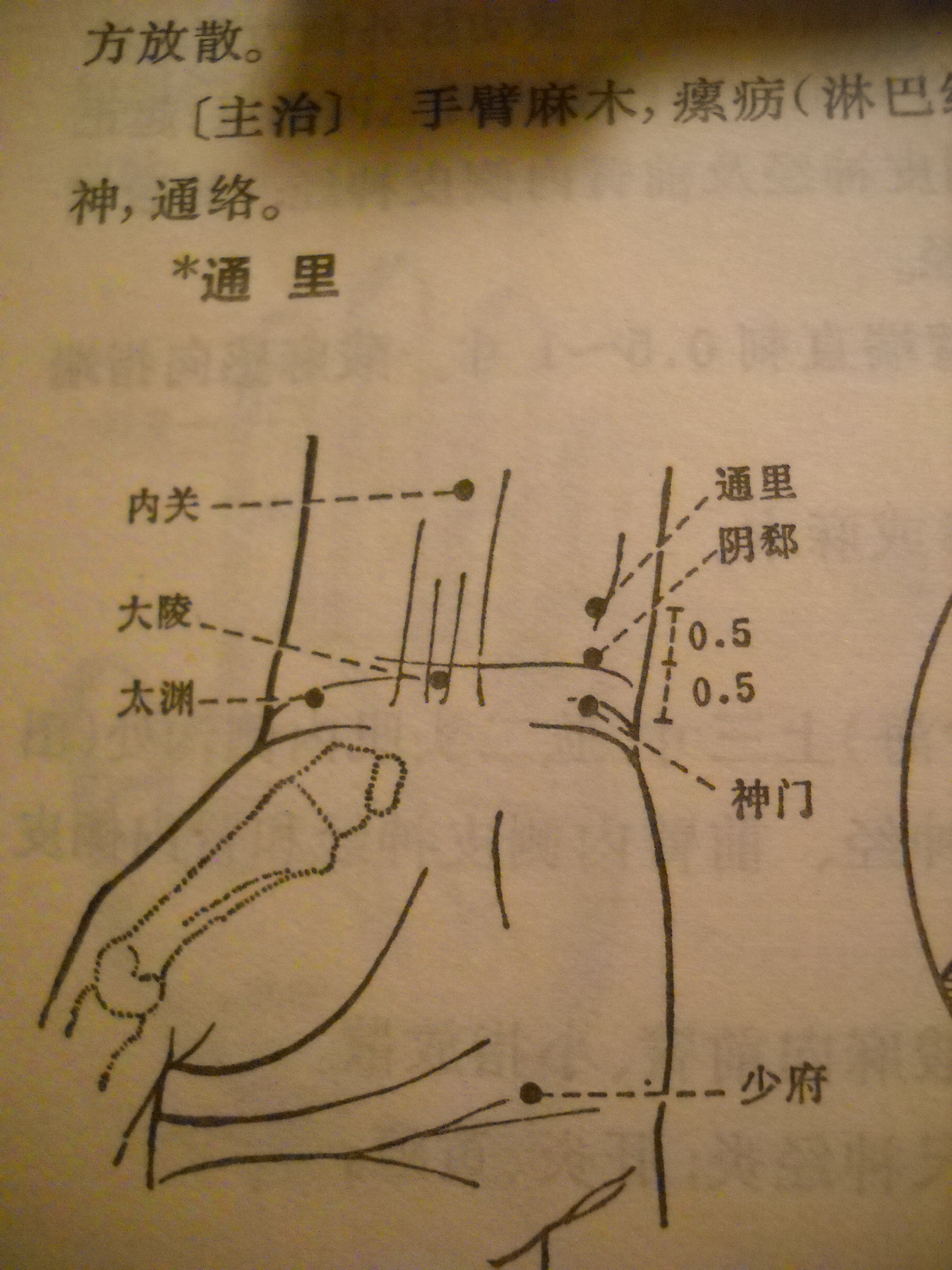 Acupuncture Points Wrist